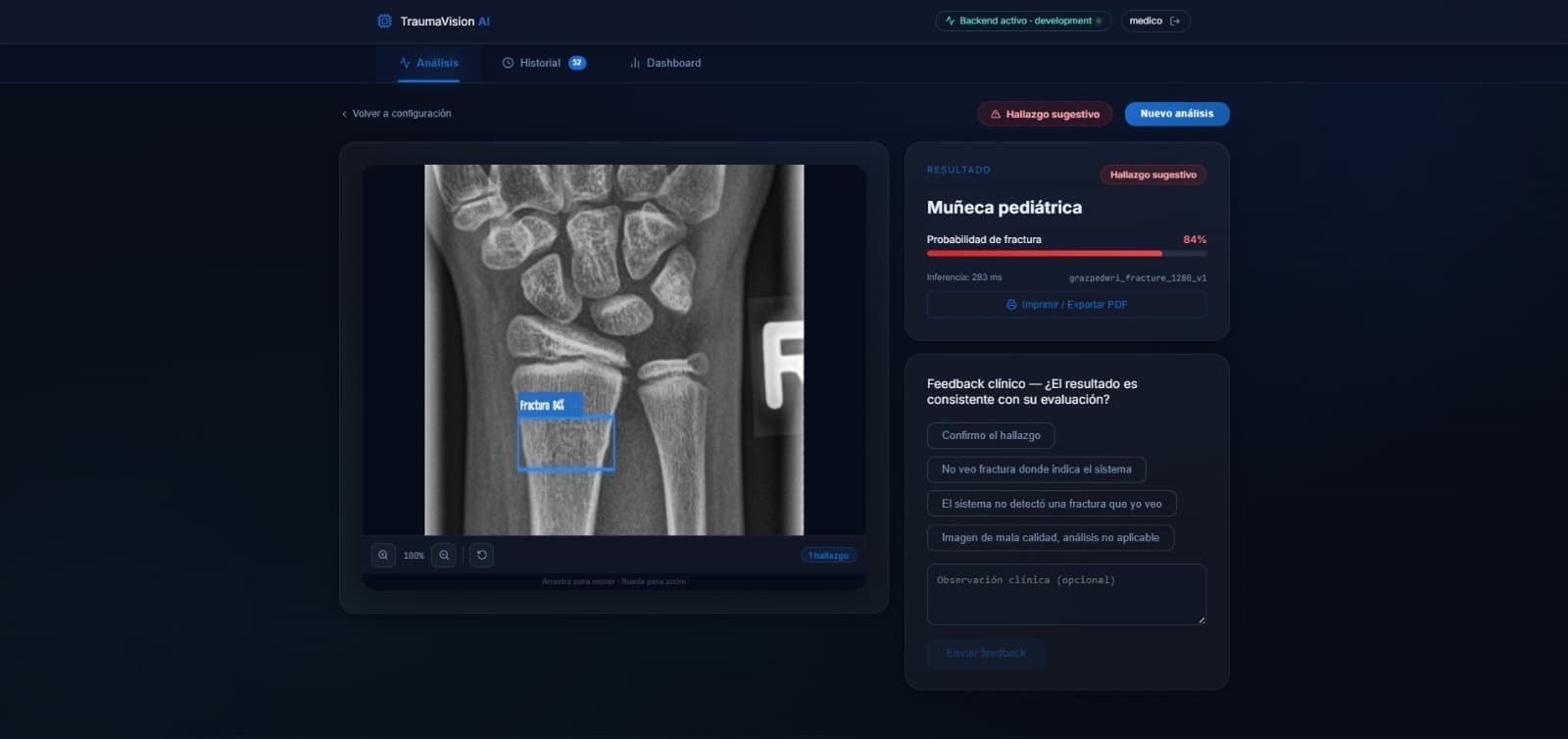 TraumaVision — Fracture detection with bounding box, 84% probability